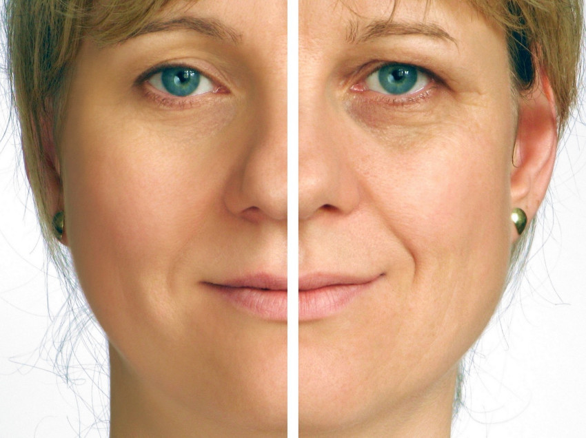 Fotos de tratamentos de pele antes e depois