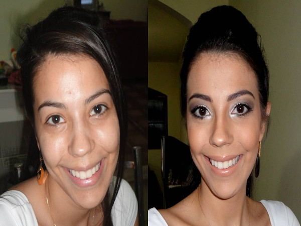 Mulher antes e depois do tratamento para bigode chinês
