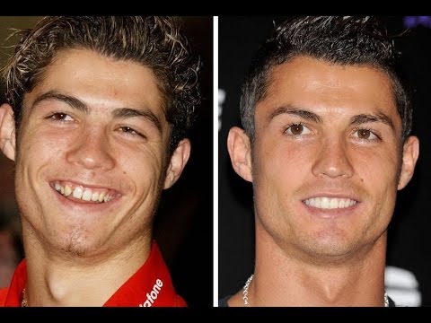 cristiano ronaldo dentes antes e depois