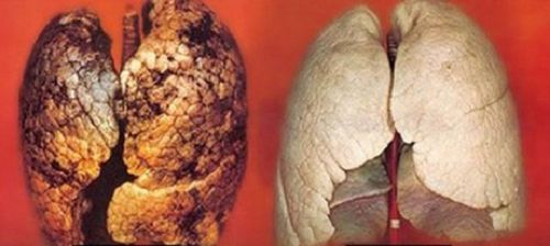 comparação pulmões