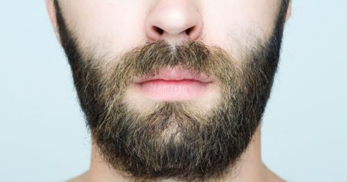 implante de barba o que é